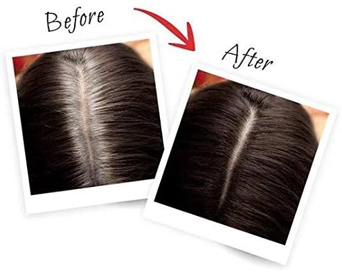 L'Oreal Paris Magic Retouch Instant Root Concealer, Dark Brown100 gm - L'Oreal Paris - Image 2