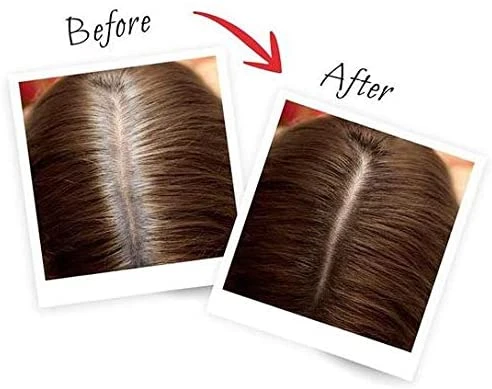 L’Oréal Paris Magic Retouch Instant Root Concealer, Brown 75 Ml - L'Oreal Paris - Image 4