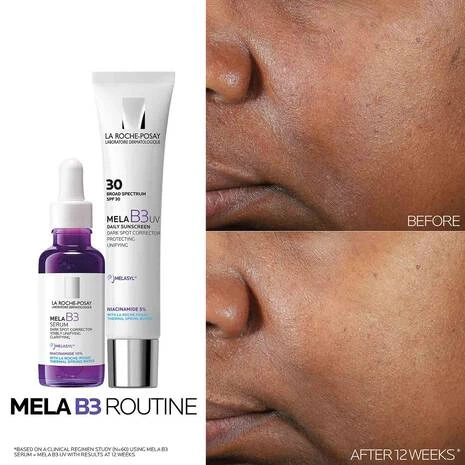 La Roche-Posay Mela B3 Intense Anti-Dark Spot Serum 30ml - La Roche Posay - Image 4