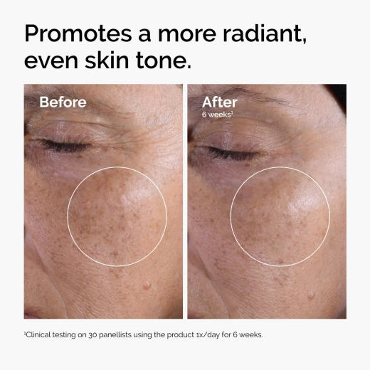 The Ordinary Glycolic Acid 7% Exfoliating Toner, Brightening and Smoothing Daily Toner for More Even-Looking Skin Tone 240ml - The Ordinary - Image 5
