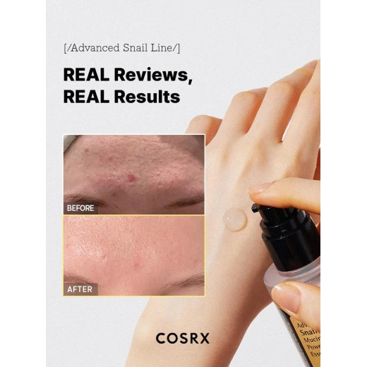 خلاصة قوة الحلزون المتطورة من Cosrx، 96 موسين، 100 مل، مصل مرطب للوجه - كوزركس - Image 4