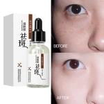 Hymey's Nicotinamide Anti Freckle Face Serum 30ml, Moisturizing, Anti-Aging, Whitening