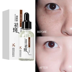 Hymey's Nicotinamide Anti Freckle Face Serum 30ml, Moisturizing, Anti-Aging, Whitening