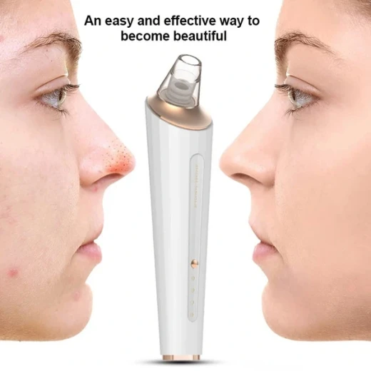 Generic Electric Blackhead Remover Pore Vacuum Cleaner USB Rechargeable with 3 Suction Modes for Deep Pore Cleansing - Generic - Image 2