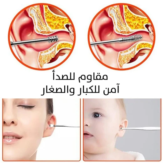 Ear Wax Removal Tool - Gold Rose Design for Safe & Effective Cleaning - Image 4