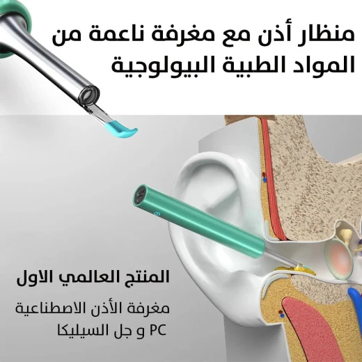 منظار إزالة شمع الأذن OTOSCOPE: تنظيف الأذن بوضوح وأمان - Image 4