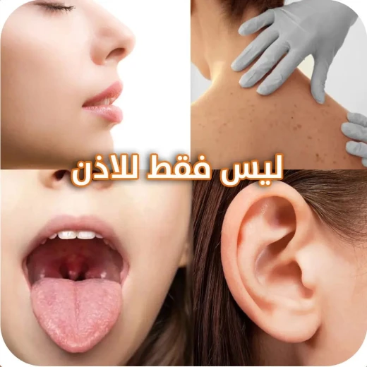 منظار إزالة شمع الأذن OTOSCOPE: تنظيف الأذن بوضوح وأمان - Image 5