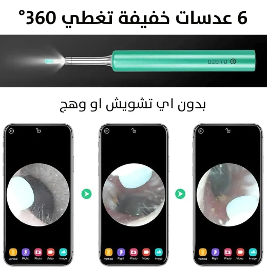 منظار إزالة شمع الأذن OTOSCOPE: تنظيف الأذن بوضوح وأمان - Image 7