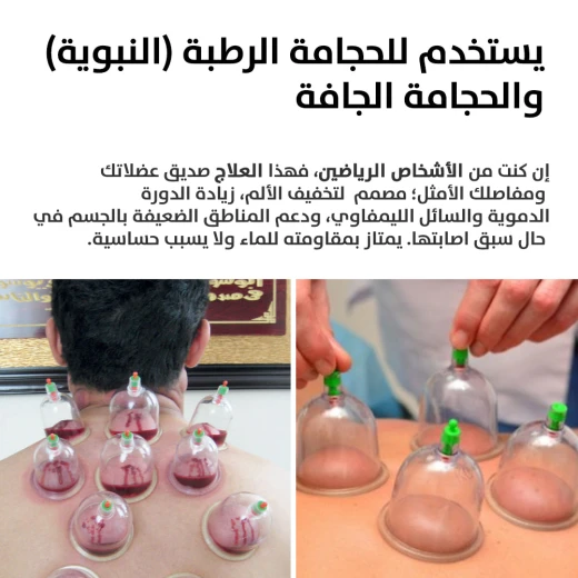 مجموعة حجامة قابلة لإعادة الشحن مع 12 كوب: شفط قوي لتخفيف الألم - Image 7