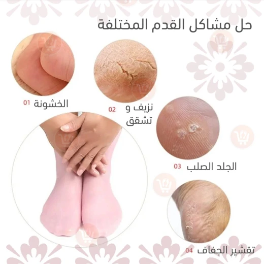 Silicone Moisturizing Socks for Dry Feet - One Pair - Image 5