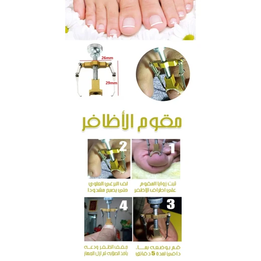 جهاز تصحيح الأظافر الغارزة: تخفيف الألم وتصحيح الأظافر - Image 3