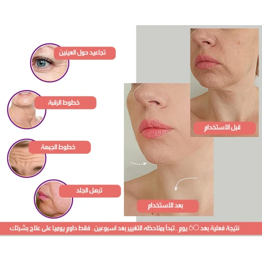 جهاز تقليل التجاعيد بتقنية الضوء النبضي المكثف العناية بالبشرة لمكافحة الشيخوخة - Image 6