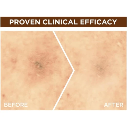 Garnier Skin Active Fast Bright Overnight Booster Face Serum with 10% Pure Vitamin C, 30ml - Garnier - Image 3