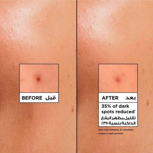 كريم غارنييه سكين أكتيف بفيتامين سي المنعش والمشرق، ترطيب يدوم 48 ساعة بدون زيوت، 4% فيتامين سي ونياسيناميد، خفيف الوزن، 85 مل - غارنييه - Image 8