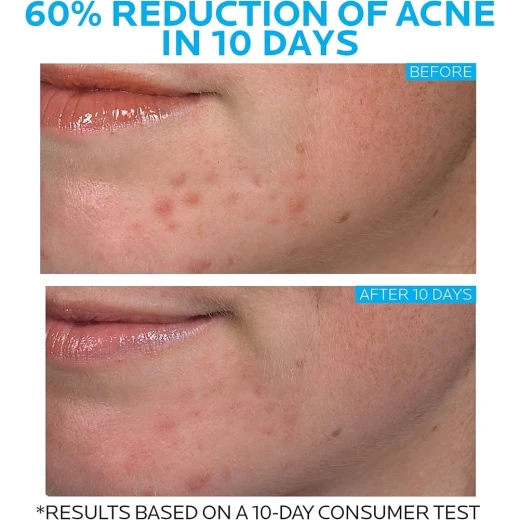 La Roche-Posay Effaclar Duo+ كريم للوجه – 40 مل - لاروش بوسيه - Image 9
