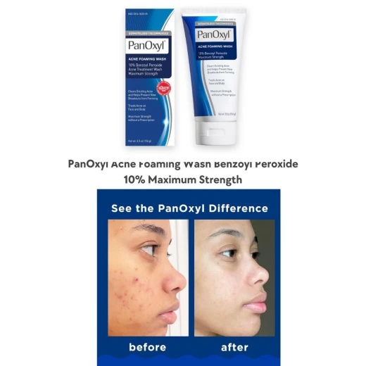 PanOxyl 10% Acne Foaming Wash170g - Panoxyl - Image 2