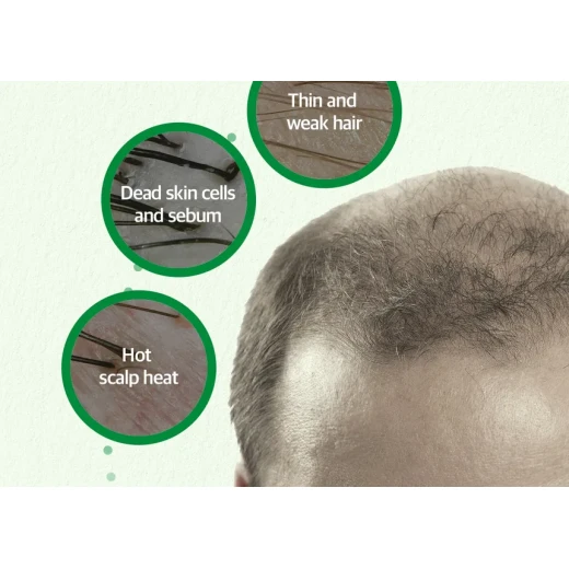 SOME BY MI - Cica Peptide Anti Hair Loss Derma Scalp Tonic 150ml - Some by mi - Image 15
