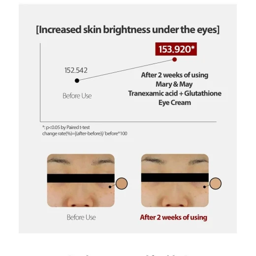 Mary & May Tranexamic Acid + Glutathione Eye Cream 30 g Brighter-looking eye area - Mary &amp; May - Image 3
