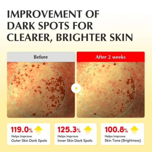 EQQUALBERRY - Vitamin Illuminating Toner 150ml - Eqqualberry - Image 4