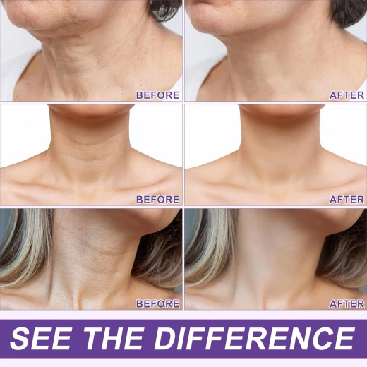 AH-8 Firming Neck Cream Lifting & Tightening Skin, Skin Body Care Neck Cream with Roller, Reduces Wrinkles and Fine Lines, Facial Moisturizer, 4.23Oz(Purple) - Ah8 - Image 2