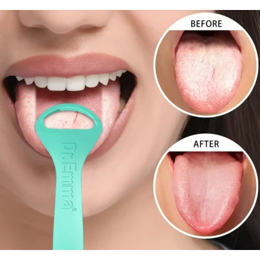 Dr. Emma Tongue Cleaner Scraper – Pack of 6, Professional Oral Hygiene Tool for Fresh Breath, Bad Breath Prevention, and Daily Dental Care - Snugsy - Image 3
