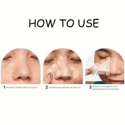 Hydrocolloid Acne Patches – 104 Pieces, 8 Sizes | Invisible Pimple Absorbing Stickers for Face & Body - Snugsy - Image 2