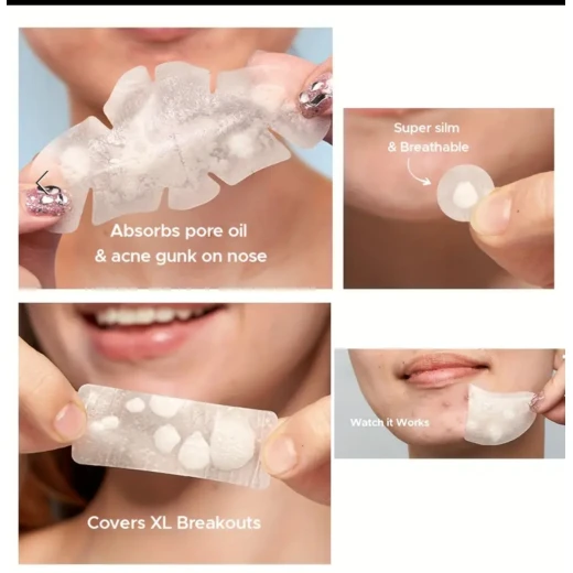 Hydrocolloid Acne Patches – 104 Pieces, 8 Sizes | Invisible Pimple Absorbing Stickers for Face & Body - Snugsy - Image 3