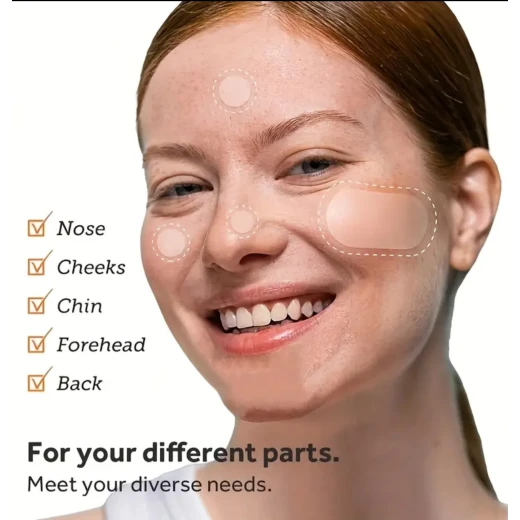 Hydrocolloid Acne Patches – 104 Pieces, 8 Sizes | Invisible Pimple Absorbing Stickers for Face & Body - Snugsy - Image 6