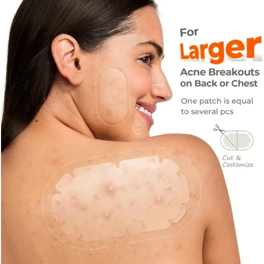 Hydrocolloid Acne Patches – 104 Pieces, 8 Sizes | Invisible Pimple Absorbing Stickers for Face & Body - Snugsy - Image 7