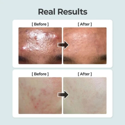 Numbuzin No. 1 Pure-Full Calming Herb Toner Soothes, Hydrates, and Balances Skin 150ml - Numbuzin - Image 2
